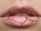 Опасный симптом: почему трескаются губы