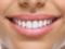 Почему стоматологи рекомендуют лазерное отбеливание