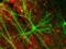 Взрослые нейроны развиваются активнее, чем их новорожденные аналоги