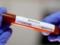 В Херсонской области разоблачили закупку некачественных тестов на коронавирус на 2 млн гривен