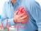 Названы факторы, увеличивающие риск инфаркта у людей старше 45 лет