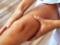 Тромб: 4 характерных признака опасного сгустка крови в ноге