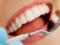 Який збиток буде завданий вашим зубам, якщо не чистити їх протягом 24 годин
