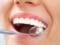 Болезни можно определить по числу зубов