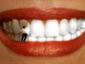 Стоматолог предупредила об опасности отбеливания зубов