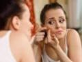 Знать врага в лицо: 5 самых вредных продуктов для твоей кожи