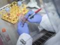 Ученые нашли причину вспышки гепатита у детей