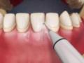 Зубная гигиена: открытие лучшего времени для чистки зубов