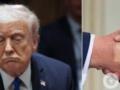 У Трампа обнаружили возрастные проблемы с венами: что еще показал медосмотр