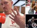 Как выглядело лицо Усика после пропущенных ударов от Дюбуа. Появилось видео из раздевалки сразу после боя