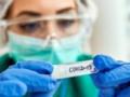 Коронавирус наступает: сколько людей умерло от COVID-19 за последнюю неделю августа