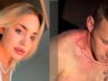 Употреблял наркотики: в Полтаве суд взял под стражу 22-летнего юношу, который жестоко убил свою сожительницу