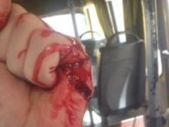 В Киеве маршрутчик напал с ножом на участника АТО