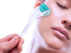 Micro-iglotherapy and its features