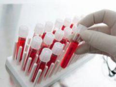 Free radicals can prolong life