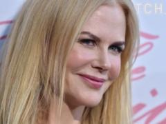 Nicole Kidman honestly told about the use of Botox