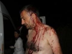 В Одесской области жестоко избили журналиста