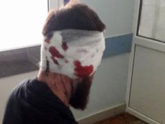 Глава полиции Харьковщины взял под личный контроль дело об избиении Булаха