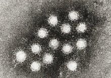 Russians warned of hepatitis outbreaks in the US