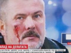 В Днепре во время футбольного матча разбили лицо нардепу Березе