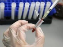 На Харьковщине семь человек заболели вирусным гепатитом