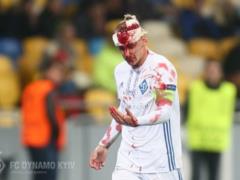 Вида может сыграть с  Шахтером , Хачериди готовится в общей группе
