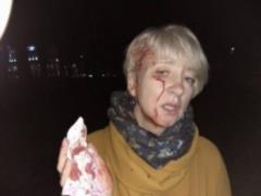 У Полтаві хулігани напали на суддю