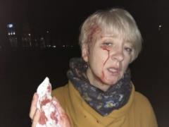 In Poltava, unknown people beat a judge who spoke out against corruption