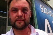 The Oblast court softened the verdict to the father and son of Lushchikov, who beat journalists and a candidate for deputy