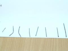 In Uzbekistan doctors could not save a child who swallowed 13 needles