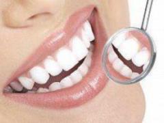 Prophylaxis of caries: tips