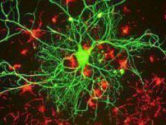 Salmonellosis will save from cancer