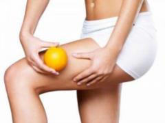 Named the TOP-8 rules that will help get rid of cellulite
