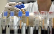 Scientists have found a way to defeat premature aging