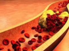 How to reduce the level of cholesterol without tablets