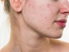 How testosterone affects women s beauty