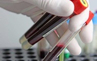 Naden, a protein that provokes blood cancer