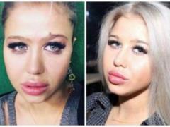 Die beautiful: the horrors of plastic surgery