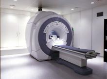 What is the MRI of the brain?
