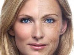 Named the six major means of tightening the skin