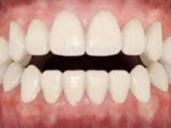 How to fix bite?