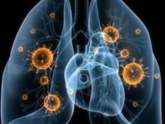 Scientists have learned to determine tuberculosis by breathing