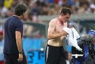 Rudi got a broken nose in the match with Sweden