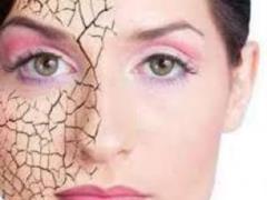 Scary skin problems that occur due to stress