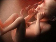 Physicians have learned to prevent birth defects before conception of a child