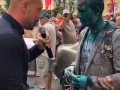 Шабунину пожгли глаза