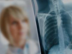 In Priazovsky colony decided to increase the incidence of tuberculosis?