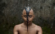 The way to prevent baldness is named