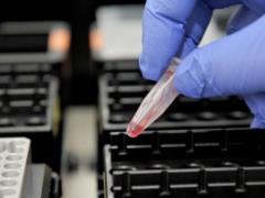 The outbreak of infection in Europe was explained by secret tests of the USA