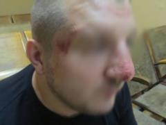 Российские пограничники избили украинца